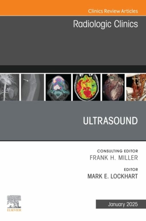 Ultrasound, An Issue of Radiologic Clinics of North America (PDF)