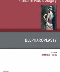 Blepharoplasty, An Issue of Clinics in Plastic Surgery (DPF)