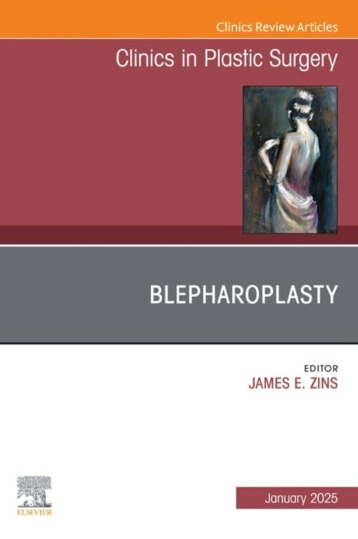 Blepharoplasty, An Issue of Clinics in Plastic Surgery (DPF)