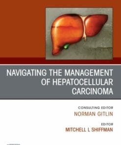 Navigating the Management of Hepatocellular Carcinoma, An Issue of Clinics in Liver Disease (PDF)