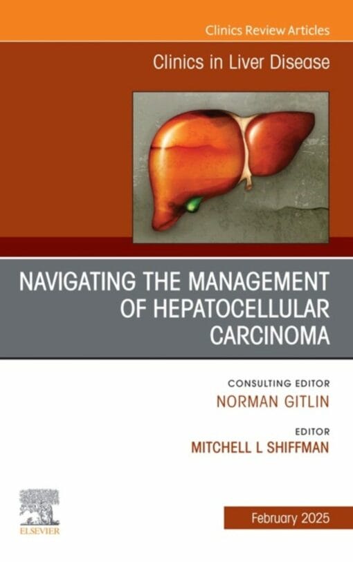 Navigating the Management of Hepatocellular Carcinoma, An Issue of Clinics in Liver Disease (PDF)