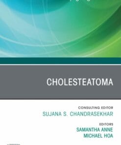 Cholesteatoma, An Issue of Otolaryngologic Clinics of North America (PDF)