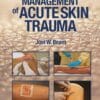 Clinical Management of Acute Skin Trauma  (EPUB)