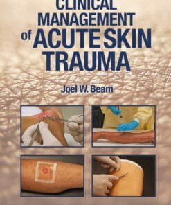 Clinical Management of Acute Skin Trauma  (EPUB)