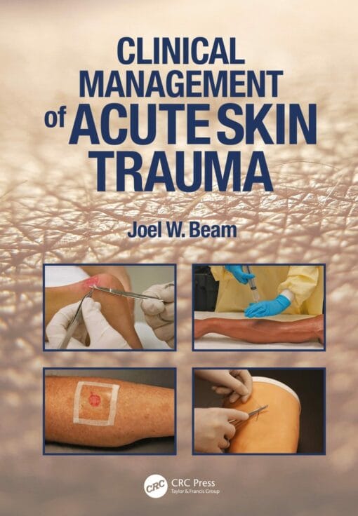 Clinical Management of Acute Skin Trauma  (EPUB)