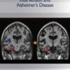 Handbook of Intervention and Alzheimer’s Disease (PDF)