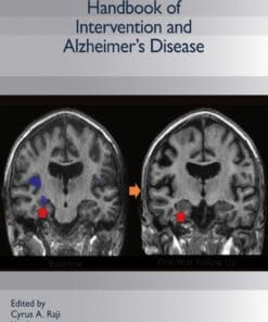 Handbook of Intervention and Alzheimer’s Disease (PDF)