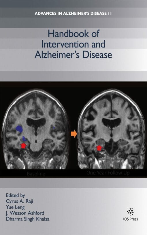 Handbook of Intervention and Alzheimer’s Disease (PDF)