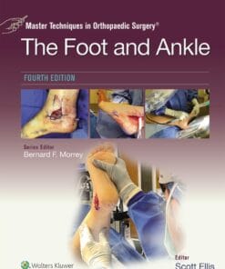 Master Techniques in Orthopaedic Surgery: The Foot and Ankle, 4th Edition (Videos)