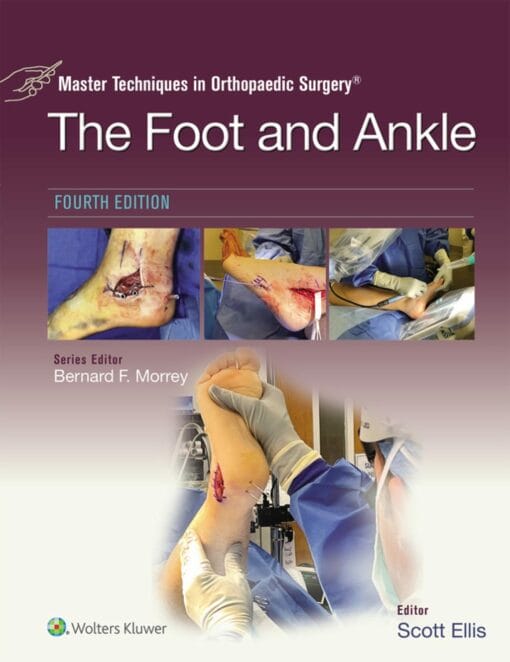 Master Techniques in Orthopaedic Surgery: The Foot and Ankle, 4th Edition (Videos)