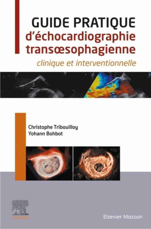 Guide pratique d’échocardiographie transœsophagienne: clinique et interventionnelle (True PDF)