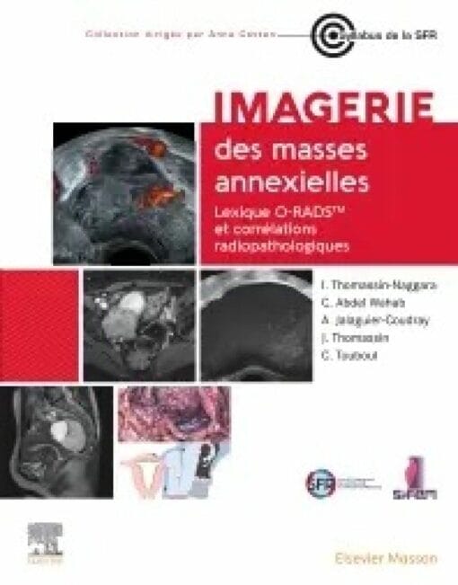 Imagerie des masses annexielles: Lexique O-RADS et corrélations radiopathologiques (PDF)