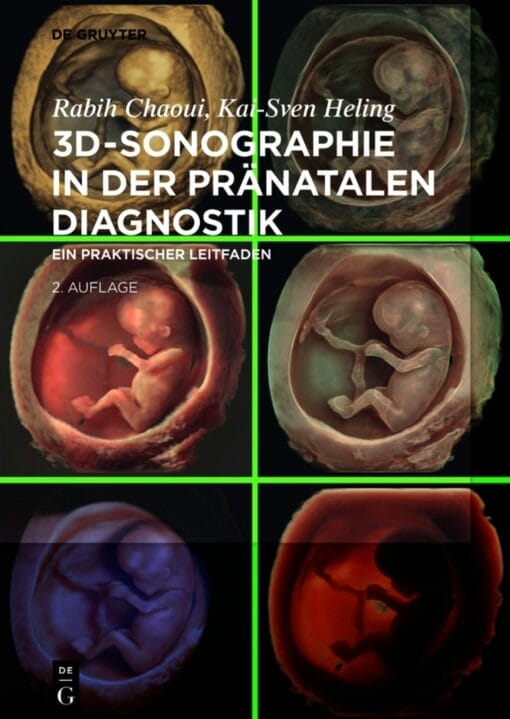 3D-Sonographie in der pränatalen Diagnostik: Ein praktischer Leitfaden, 2nd Edition (PDF)