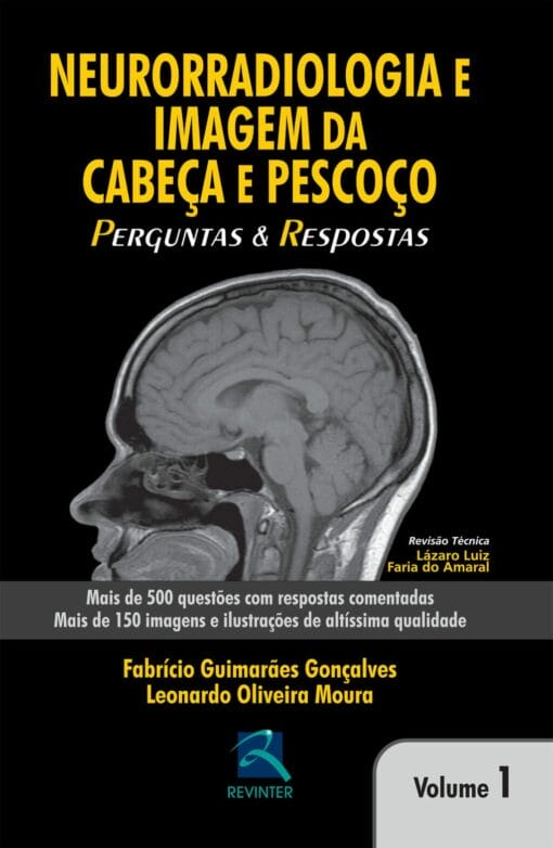 Neurorradiologia e Imagem da Cabeça e Pescoço : Perguntas e Respostas – Volume 1 (EPUB)