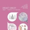 ESMO Breast Cancer: Essentials for Clinicians, 2nd Edition (PDF)