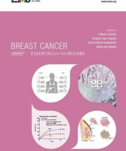 ESMO Breast Cancer: Essentials for Clinicians, 2nd Edition (PDF)