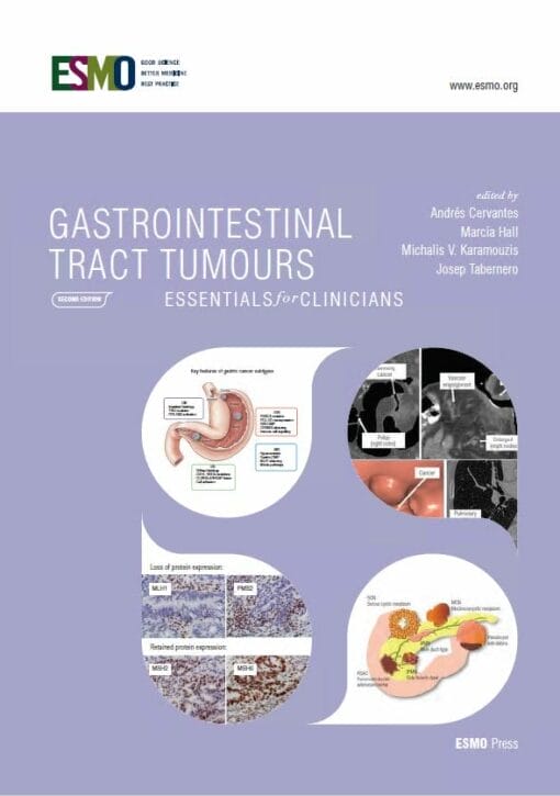 ESMO Gastrointestinal Tract Tumours: Essentials for Clinicians, 2nd Edition (PDF)