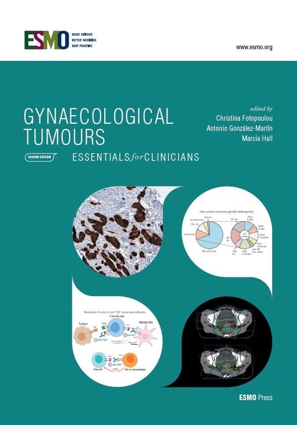 ESMO Gynaecological Tumours: Essentials for Clinicians, 2nd Edition (PDF)