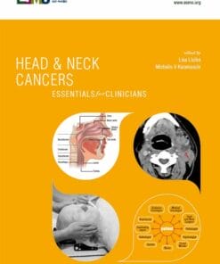 ESMO Head & Neck Cancers: Essentials for Clinicians (PDF)