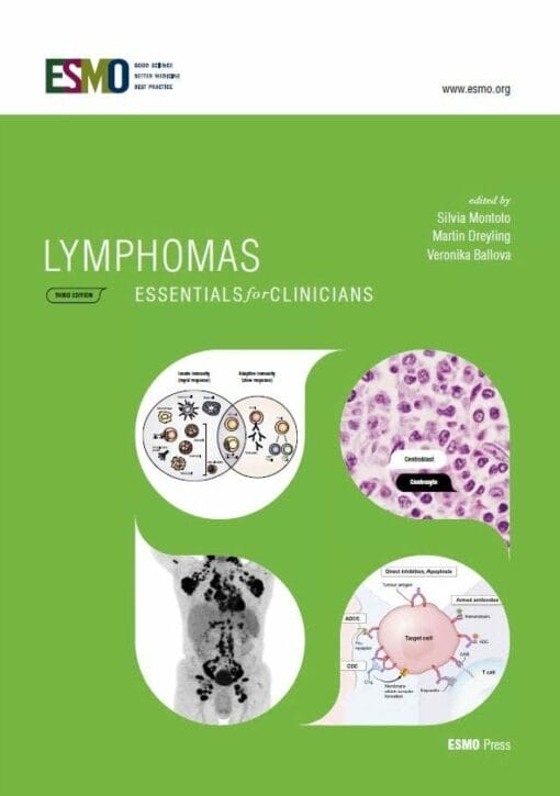 ESMO Lymphomas: Essentials for Clinicians, 3rd Edition (PDF)