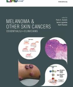 ESMO Melanoma & Other Skin Cancers: Essentials for Clinicians (PDF)