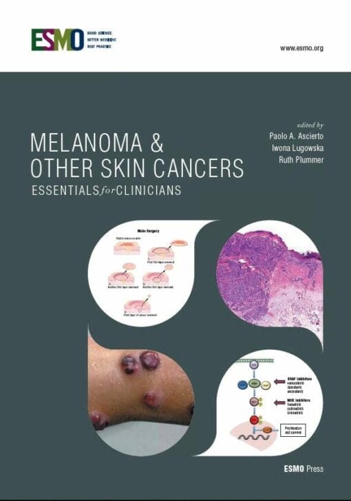 ESMO Melanoma & Other Skin Cancers: Essentials for Clinicians (PDF)