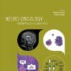 ESMO Neuro-Oncology: Essentials for Clinicians (PDF)