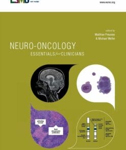 ESMO Neuro-Oncology: Essentials for Clinicians (PDF)