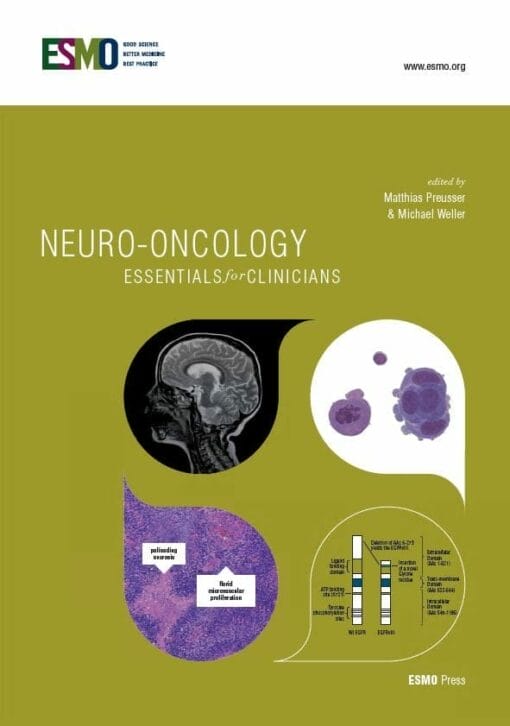 ESMO Neuro-Oncology: Essentials for Clinicians (PDF)