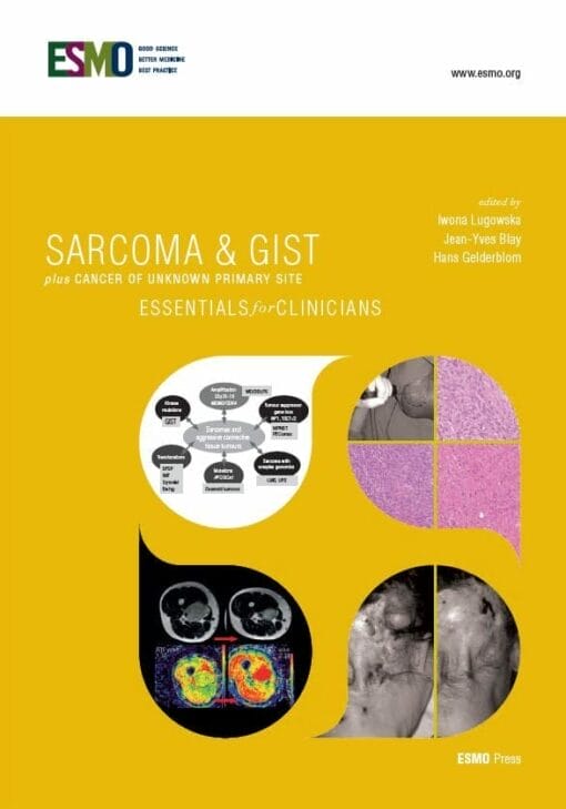 ESMO Sarcoma & GIST plus Cancer of Unknown Primary Site: Essentials for Clinicians (PDF)