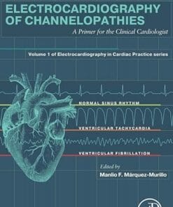 Electrocardiography of Channelopathies: A Primer for the Clinical Cardiologist (PDF)