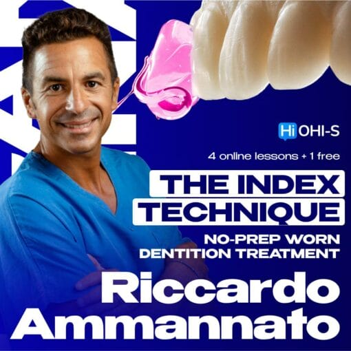 OHI-S – The Index Technique – No Prep Worn Dentition Treatment – Riccardo Ammannato