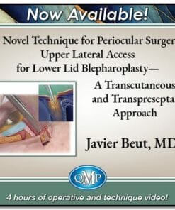 Quality Medical Publishing A Novel Technique for Periocular Surgery Upper Lateral Access for Lower Lid Blepharoplasty 2024