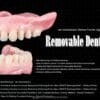 OHI-S Removable Dentures – Jan Schünemann, Markus Fischer, Eduard Cherkashin