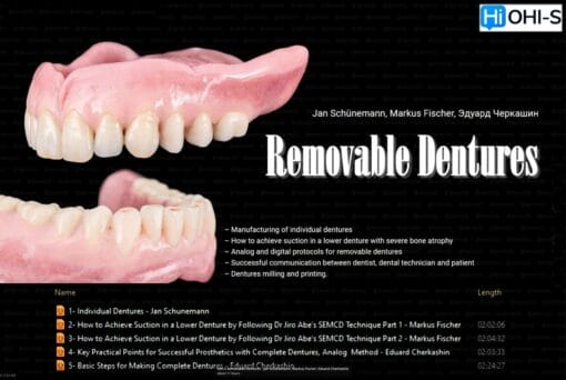 OHI-S Removable Dentures – Jan Schünemann, Markus Fischer, Eduard Cherkashin