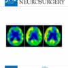 Journal of Neurosurgery 2025 Volume 142: Issue 1 (True PDF+Video)