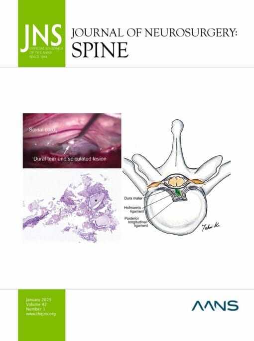 Journal of Neurosurgery: Spine 2025 Volume 42: Issue 1 (True PDF+Videos)