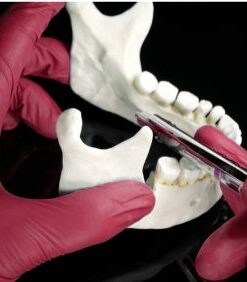 Exodontia Comprehensive Oral Surgery – Jason Hoium Module 14-18