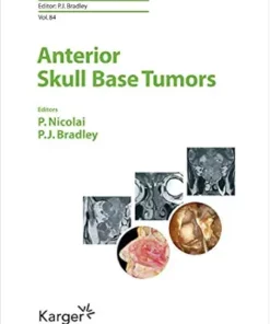 Anterior Skull Base Tumors (ISSN) (EPUB)