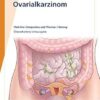 Fast Facts: Ovarialkarzinom (German Edition) (PDF) Fast Facts: Ovarialkarzinom (German Edition) (PDF)