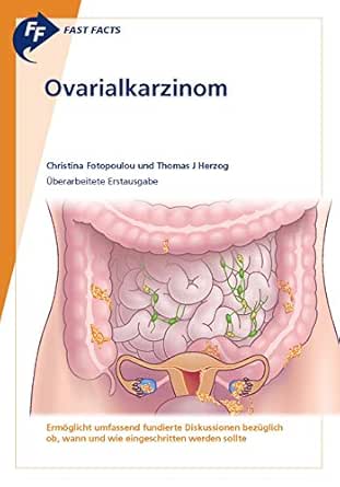 Fast Facts: Ovarialkarzinom (German Edition) (PDF) Fast Facts: Ovarialkarzinom (German Edition) (PDF)