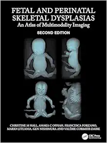 Fetal and Perinatal Skeletal Dysplasias: An Atlas of Multimodality Imaging, 2nd Edition (EPUB) Fetal and Perinatal Skeletal Dysplasias: An Atlas of Multimodality Imaging, 2nd Edition (EPUB)
