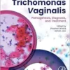 Trichomonas vaginalis: Pathogenesis, Diagnosis, and Treatment (True PDF )