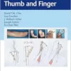 Reconstruction of the Thumb and Finger (EPUB) Reconstruction of the Thumb and Finger (EPUB)