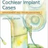 Complex Cochlear Implant Cases: Management and Troubleshooting (EPUB) Complex Cochlear Implant Cases: Management and Troubleshooting (EPUB)