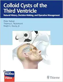 Colloid Cysts of the Third Ventricle: Natural History, Decision-Making, and Operative Management (EPUB) Colloid Cysts of the Third Ventricle: Natural History, Decision-Making, and Operative Management (EPUB)