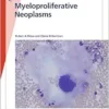Myeloproliferative Neoplasms (Fast Facts) (EPUB) Myeloproliferative Neoplasms (Fast Facts) (EPUB)