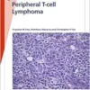 Fast Facts: Peripheral T-cell Lymphoma: Unravelling the: complexities of diagnosis and management (EPUB)