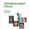 Hypopharyngeal Cancer (Advances in Oto-Rhino-Laryngology) (EPUB) Hypopharyngeal Cancer (Advances in Oto-Rhino-Laryngology) (EPUB)