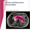 Fast Facts: Acute and Recurrent Pancreatitis (EPUB)